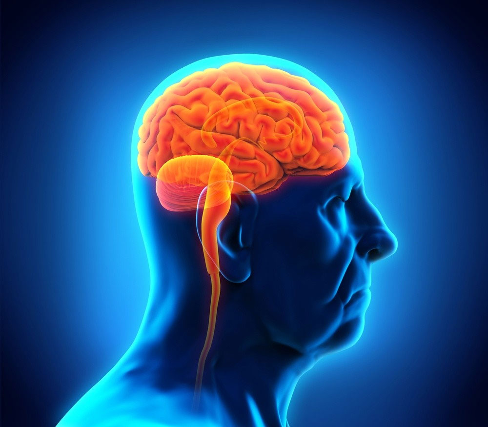 image of a brain Chiari Malformation