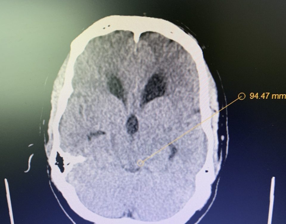 IMG 3734 JLB 2022 Brainstem Tumor EBlast Photo 2 scaled e1649447573169