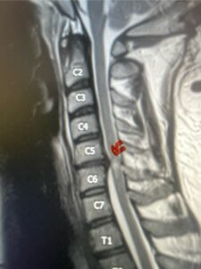 IMG_4602 Fig. 4