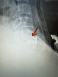 IMG_4603 Fig. 5